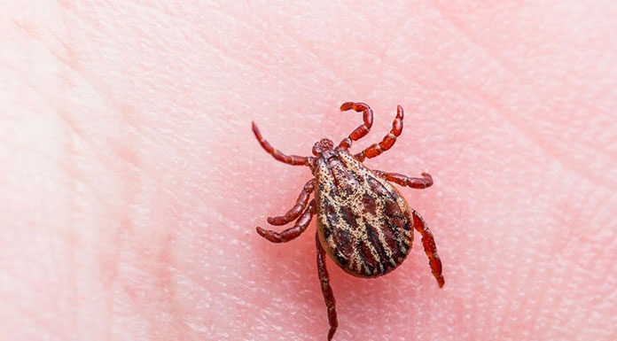Jak usunąć kleszcza bez żadnego problemu? Jak usunąć kleszcza bez żadnego problemu
